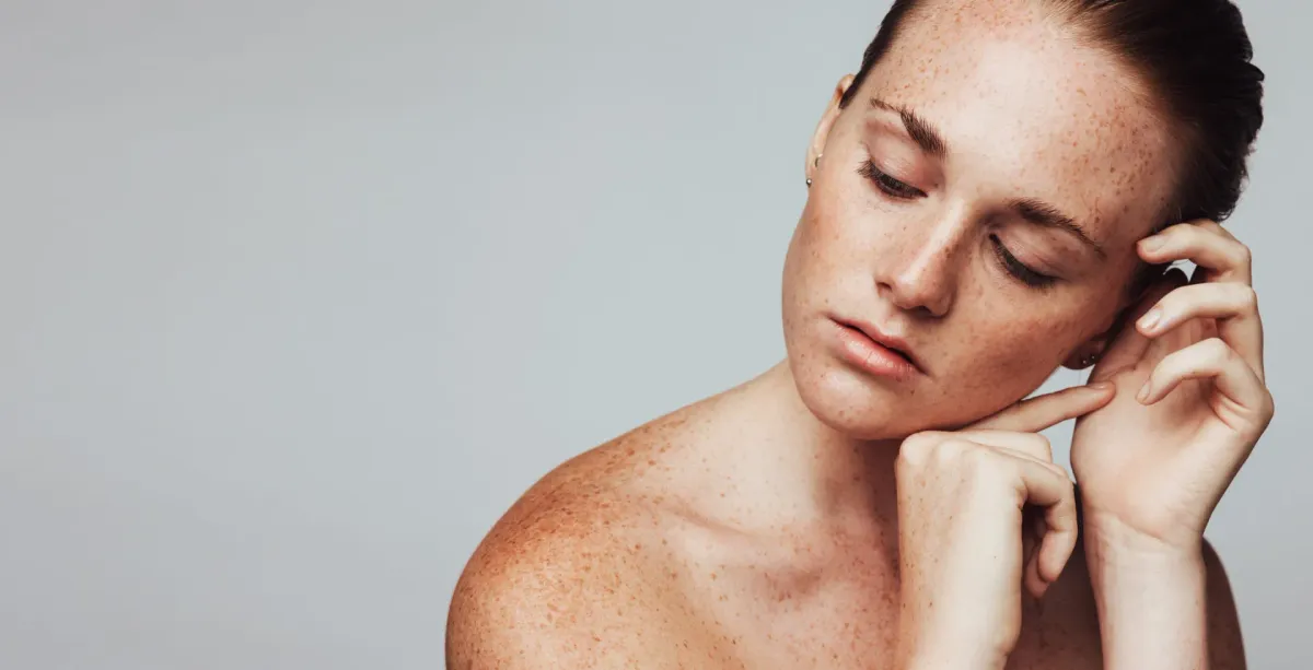 Sardas — Dermatologia Clínica na Clínica Mansur em Juiz de Fora